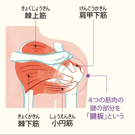 こんにちは！北山鍼灸整骨院です😊 本日は腱板損傷についてお話...